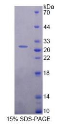 SDS-PAGE (ETF1-1397H).jpg